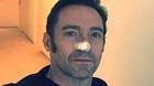 Hugh-jackman-es-operado-por-sexta-vez-de-su-cancer-de-piel-c_s