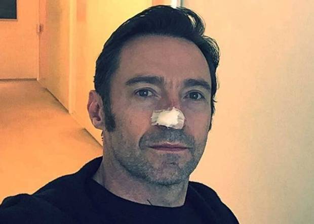 Hugh Jackman es operado por sexta vez de su cáncer de piel