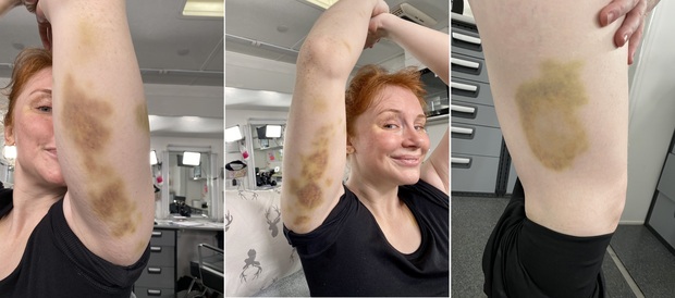 Bryce Dallas Howard muestra sus heridas tras grabar escenas de riesgo en Jurassic World 3