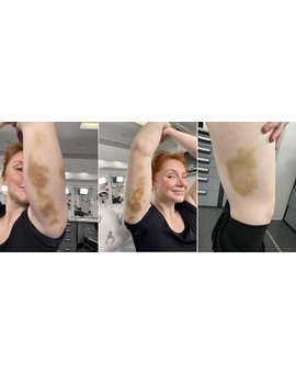 Bryce Dallas Howard muestra sus heridas tras grabar escenas de riesgo en Jurassic World 3