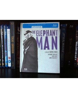 El Hombre Elefante 1/5