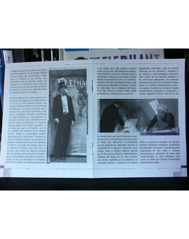 El Hombre Elefante 3/5