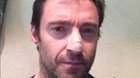 Hugh-jackman-revela-que-tiene-cancer-de-piel-animo-hugh-c_s