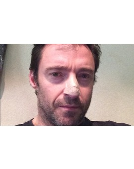 HUGH JACKMAN revela que tiene cáncer de piel. ¡Ánimo, Hugh!